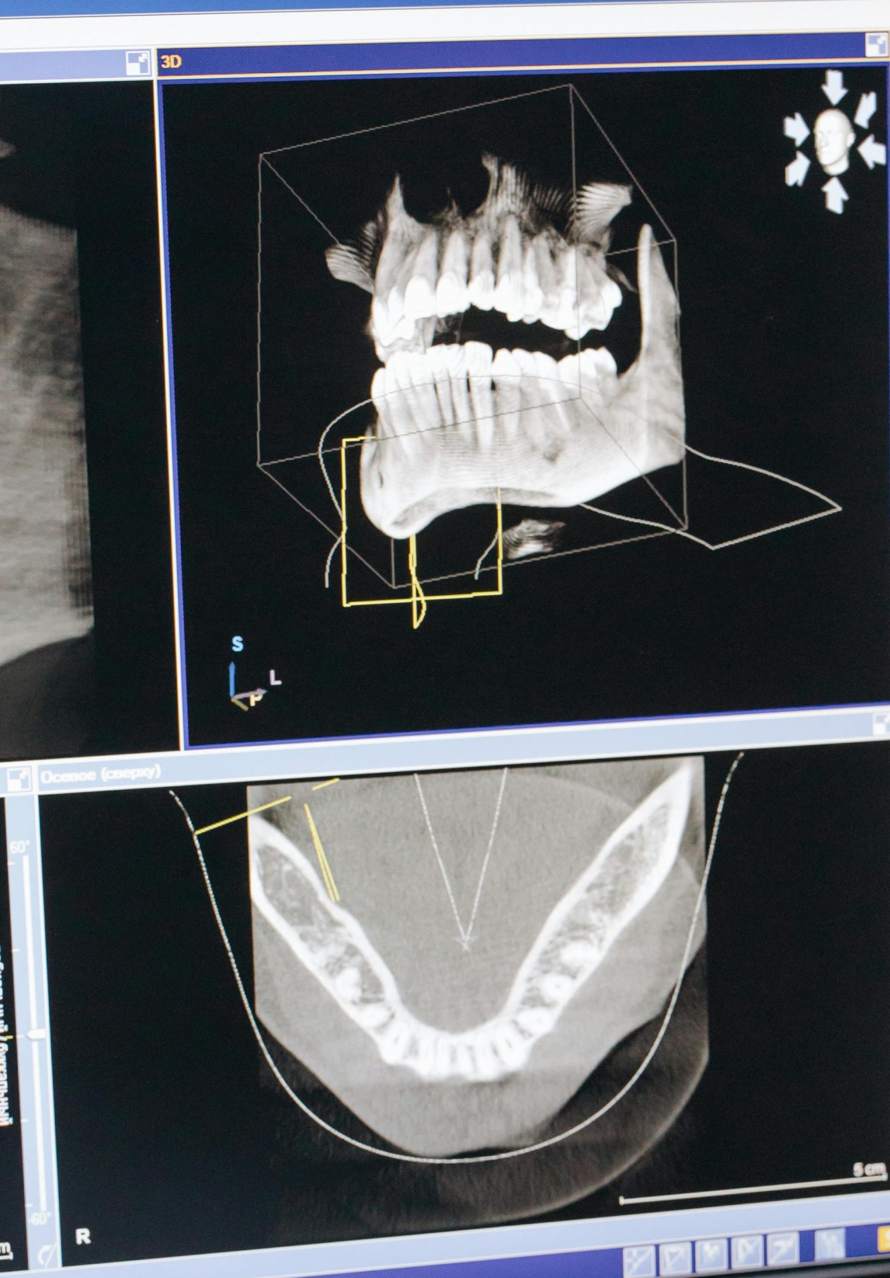 escaner completo Escáner 3D dental (CBCT) - Tecnología de tomografía computarizada